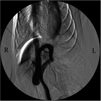 FIGURE 3