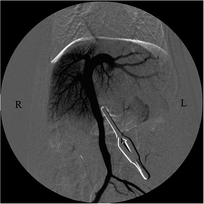FIGURE 6