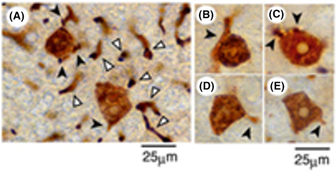 FIGURE 3
