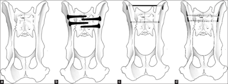 Figure-1