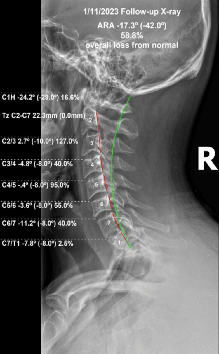 Figure 4
