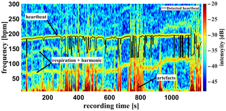 Figure 11