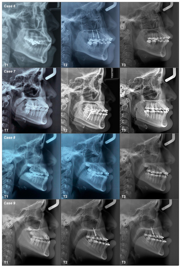 Figure 9