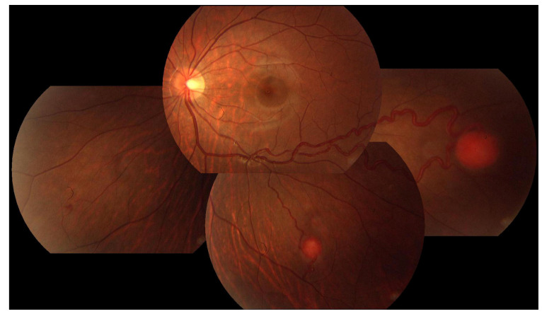 Figure 4
