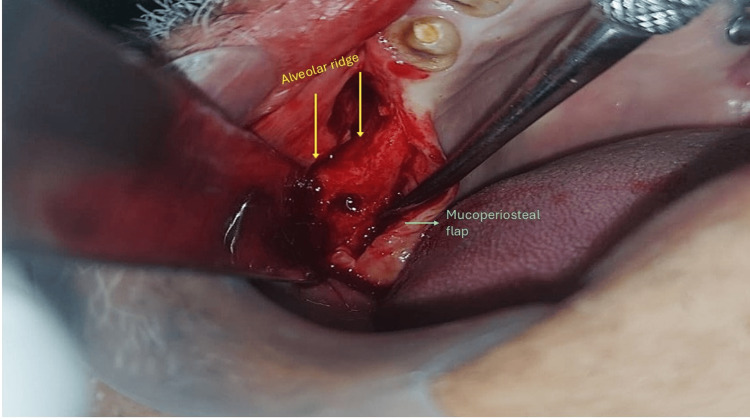 Figure 4