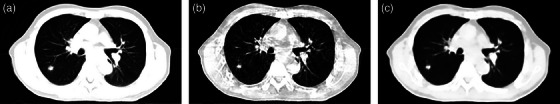 FIGURE 2