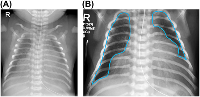 Figure 1