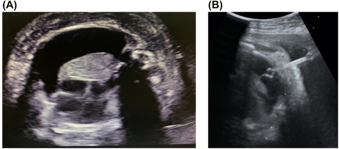 Figure 1