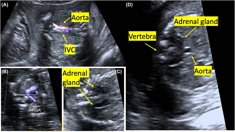 Figure 1