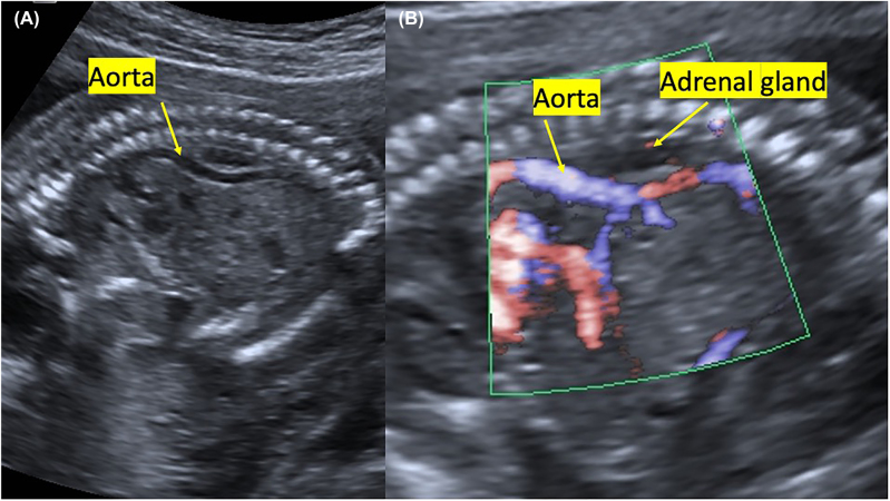 Figure 2