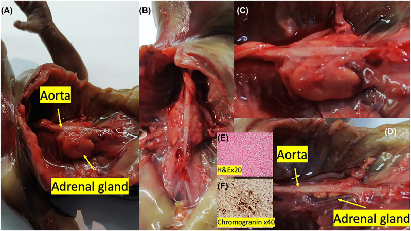 Figure 3
