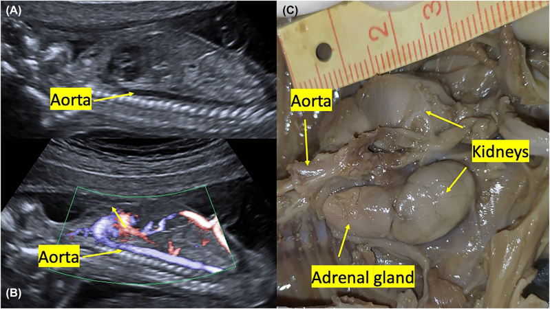 Figure 4