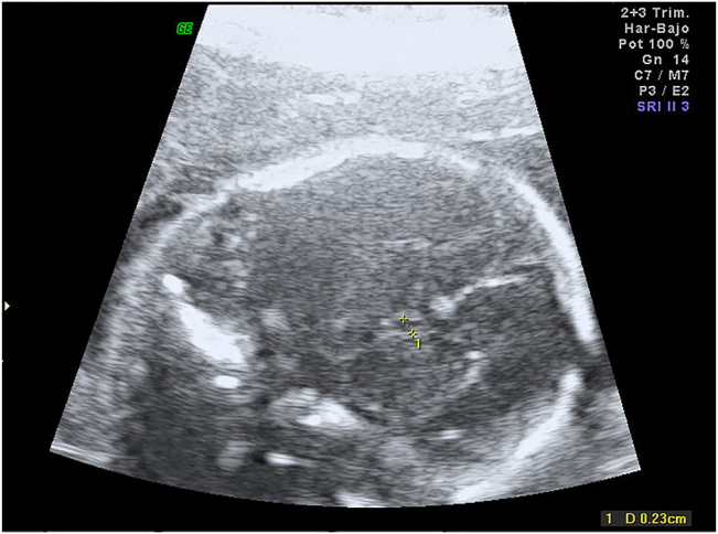 Figure 1
