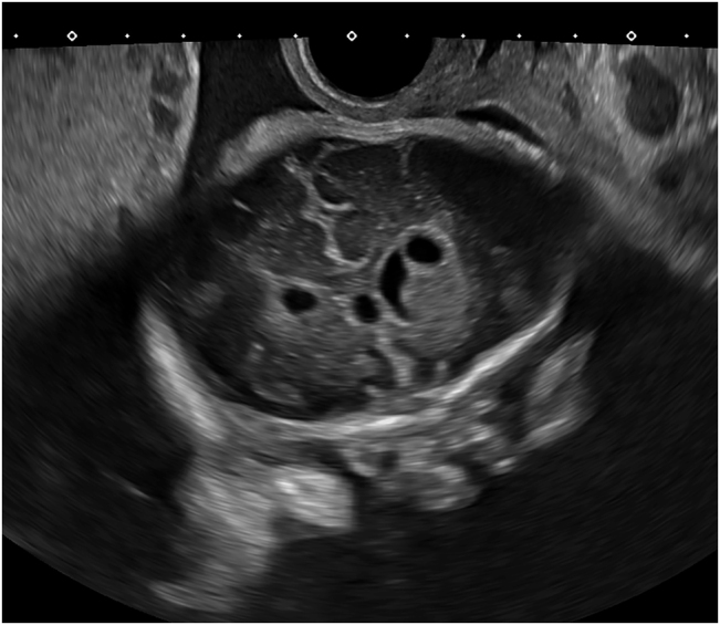 Figure 2