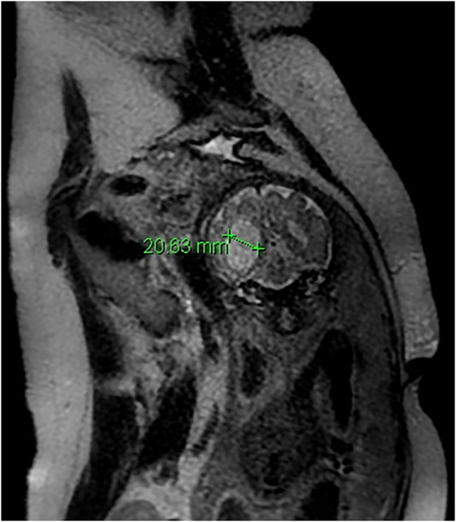 Figure 3