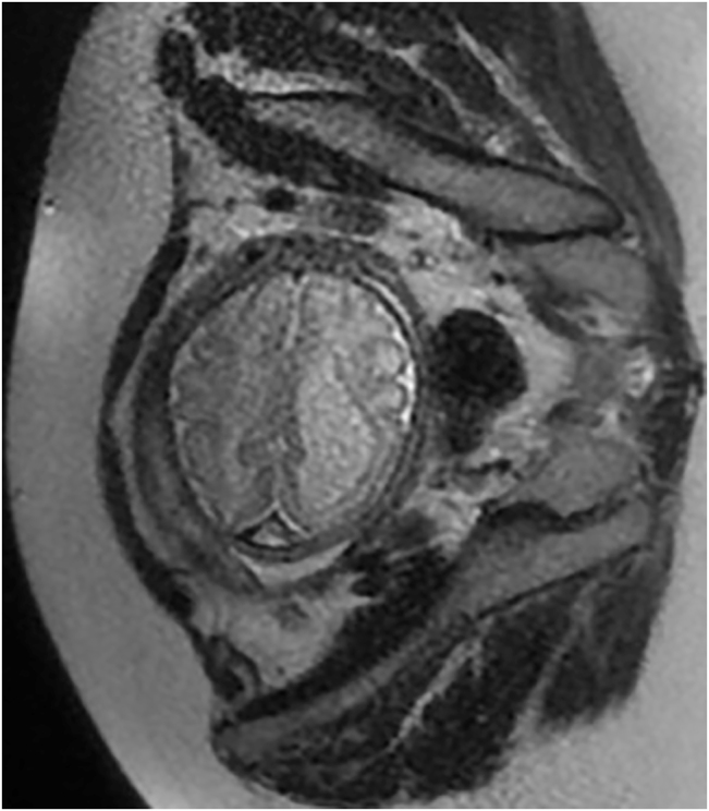 Figure 4