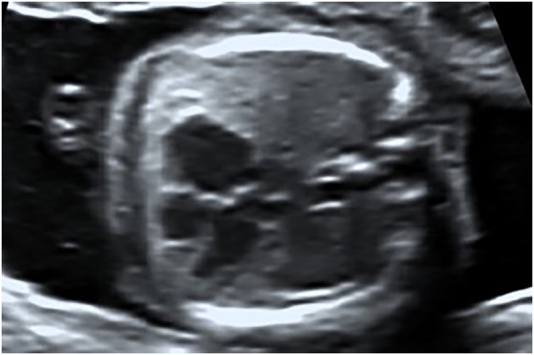 Figure 3