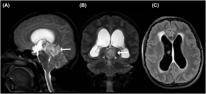 Figure 1
