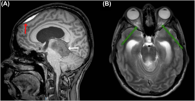 Figure 2