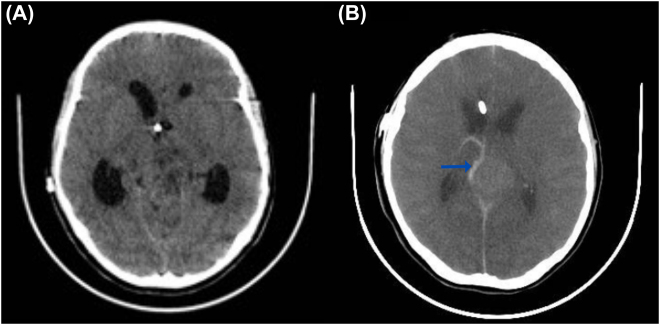 Figure 3