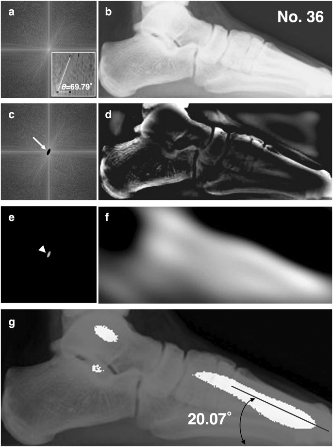 Fig 4