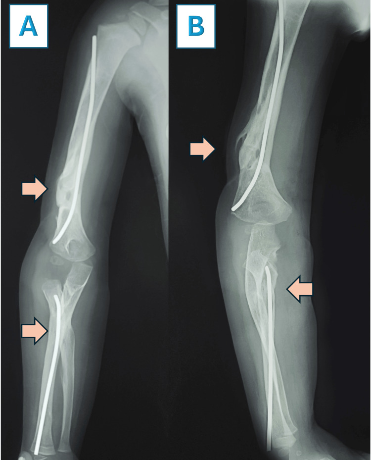Figure 9