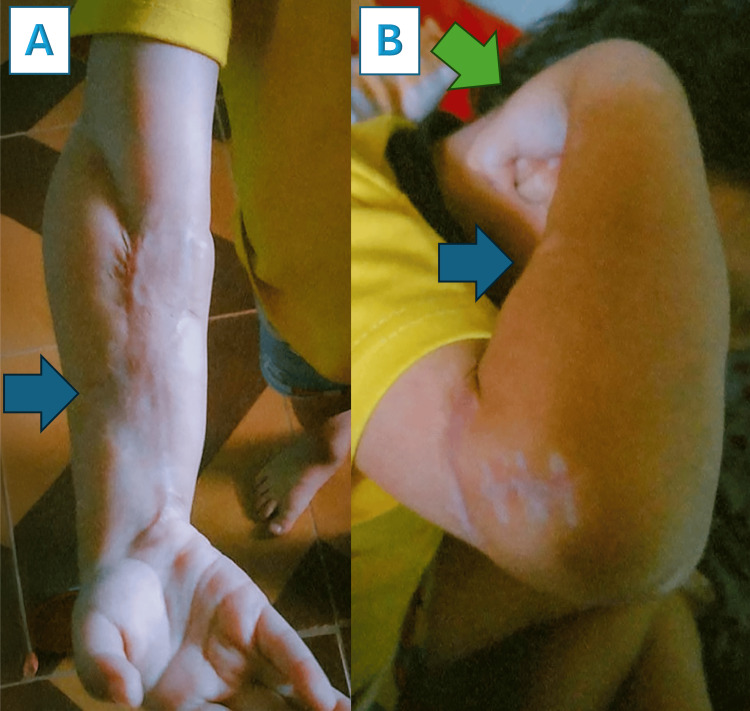 Figure 10