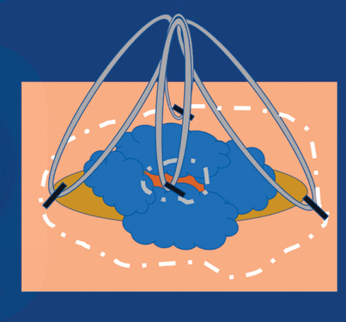 Fig. 2
