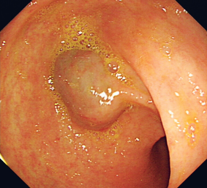 Fig. 1