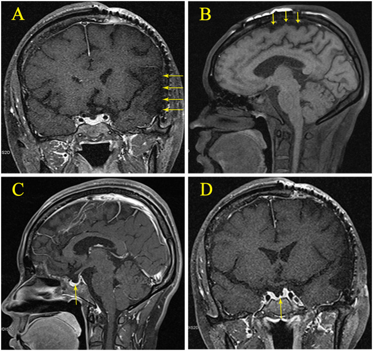 Figure 2