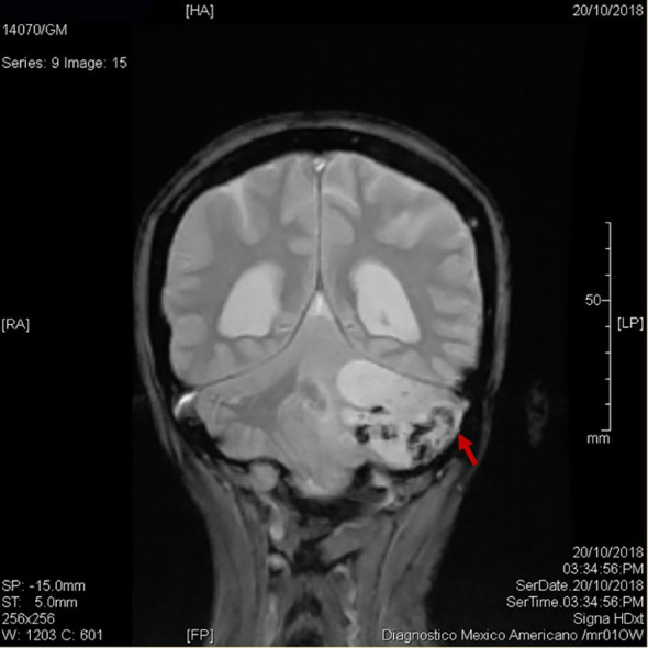 Figure 1