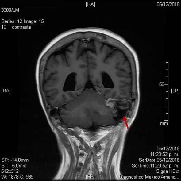 Figure 3