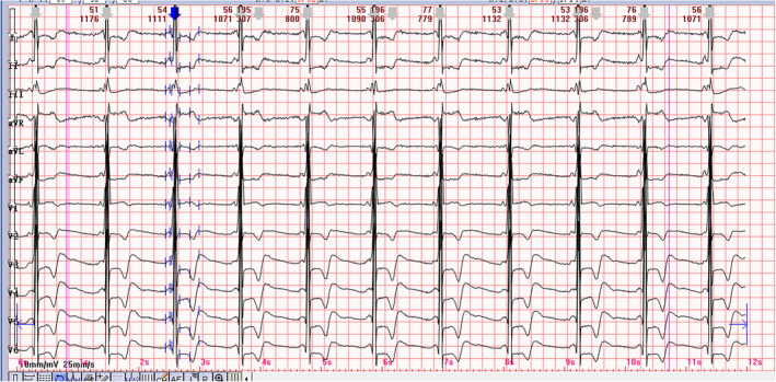 FIGURE 1