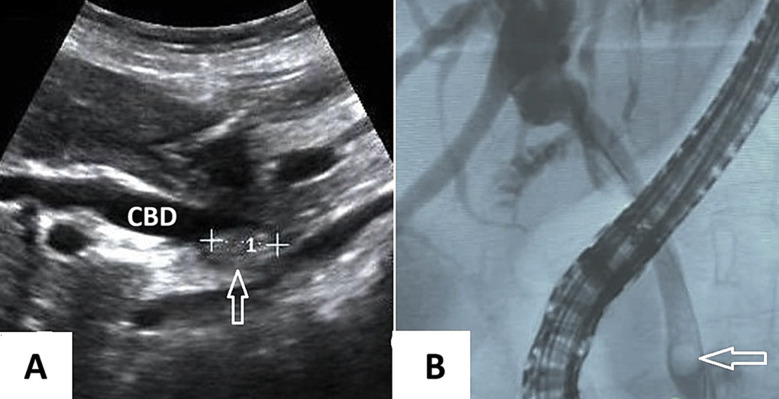 Fig.1