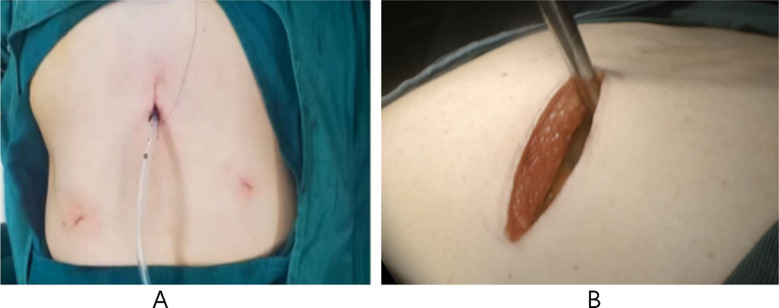 Fig.2