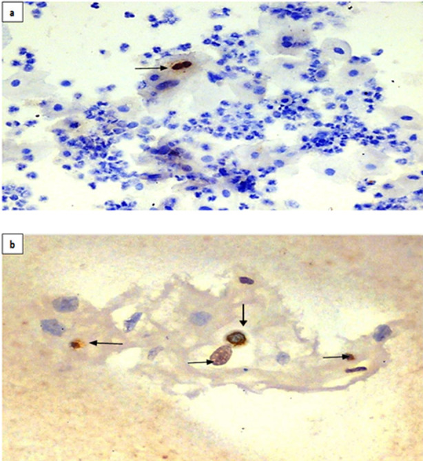 Fig.2