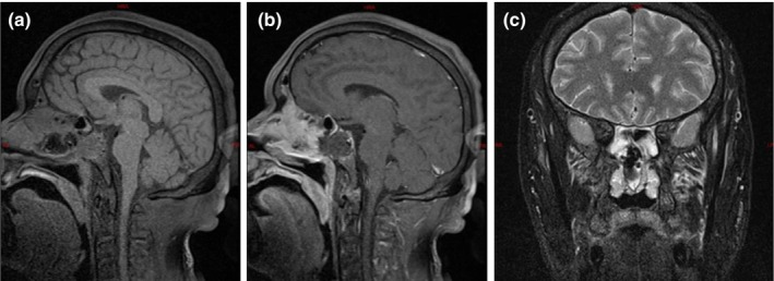 FIGURE 3