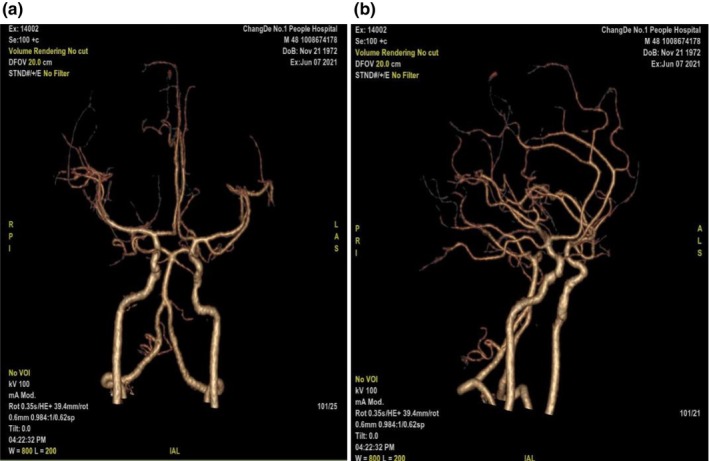 FIGURE 1