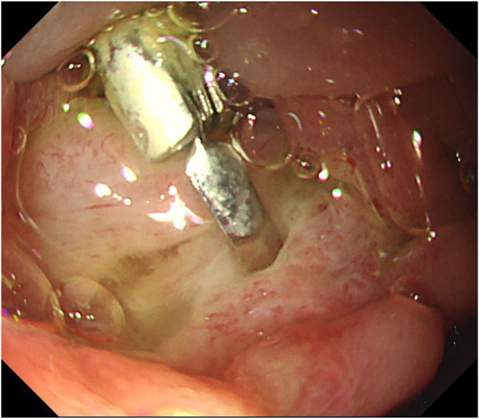 Figure 7