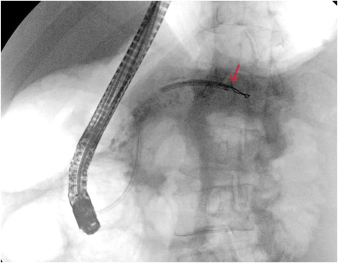 Figure 9