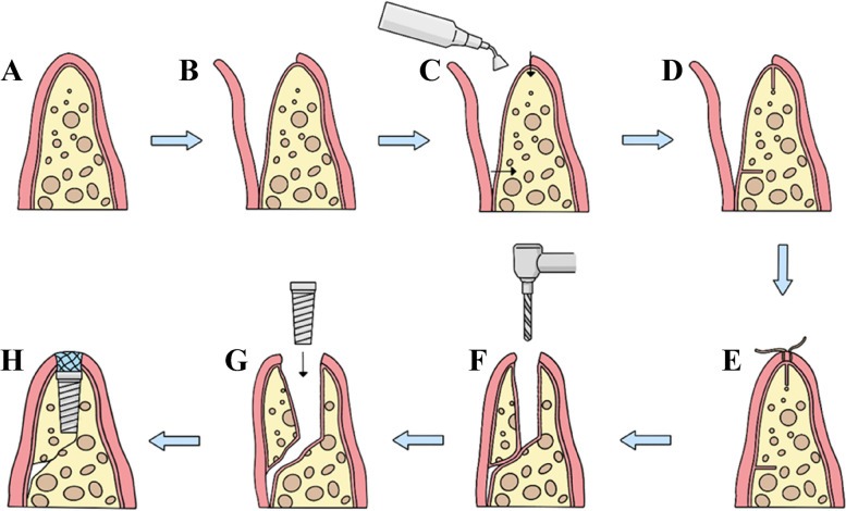 Fig. 1