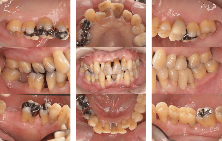 Figure 11