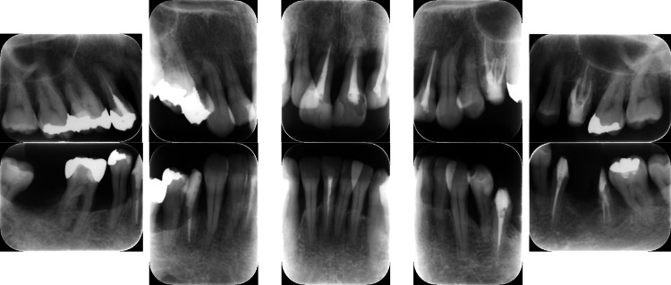 Figure 12