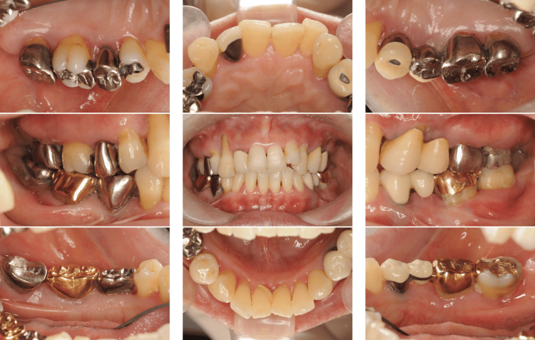 Figure 13