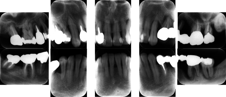 Figure 14