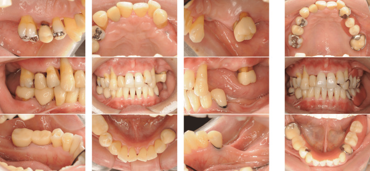 Figure 15