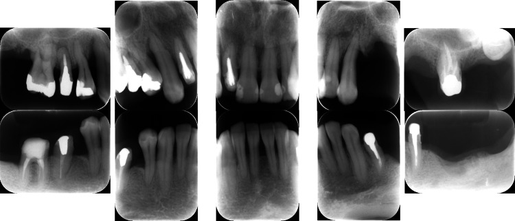 Figure 16