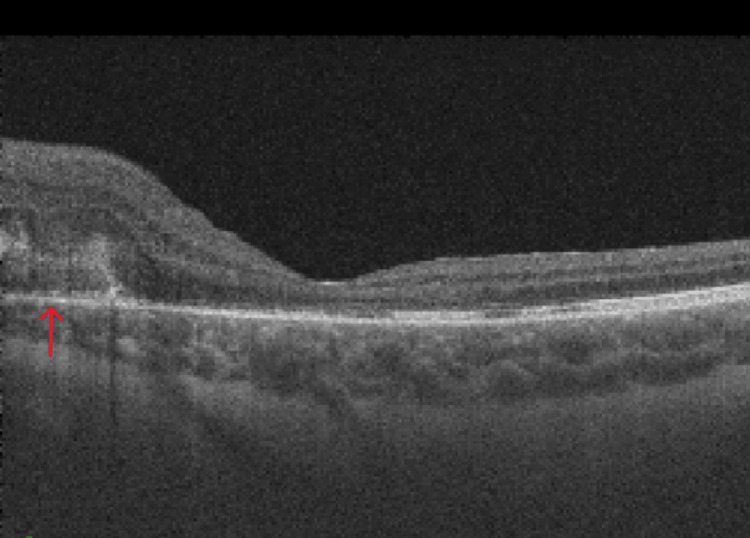 Figure 6