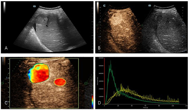 Figure 1