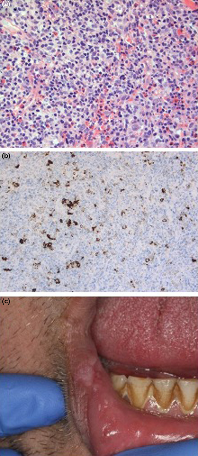 FIGURE 2